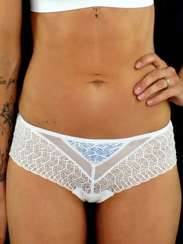 Shorty blanc en dentelle blake et coque bleue