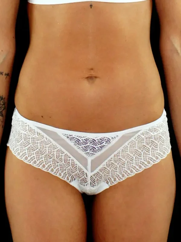Emeline porte un shorty en dentelle blake et coque violette