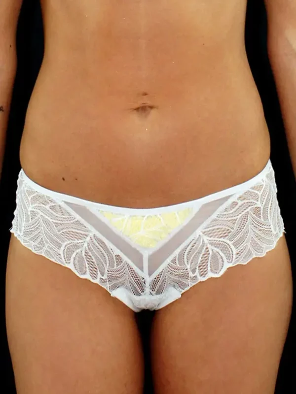 Shorty en dentelle salma blanche et coque jaune