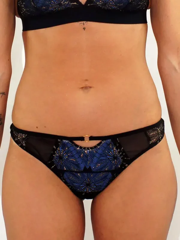 Tanga en dentelle romy noire et coque bleue