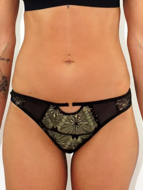Tanga en dentelle romy noire et coque jaune